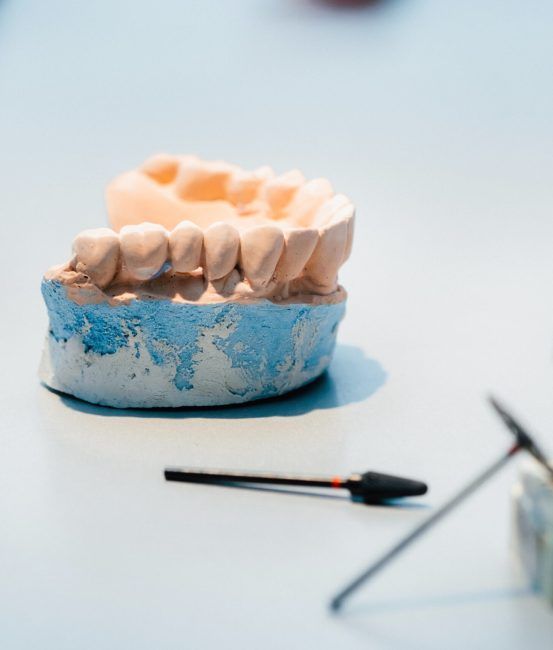 Model of teeth made of plaster of the jaw for dental technicians.